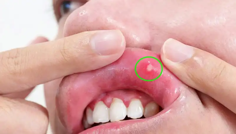 Kanserin Habercisi Olan Belirtileri Göz Ardı Eden Bir Adamın Dramı