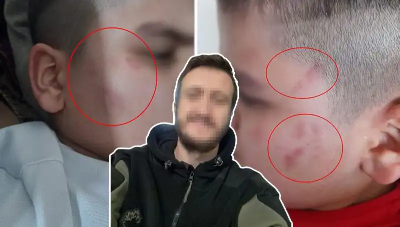Okulda Otizmli Çocuğa Dayak Attıkları İddia Edildi: Aile Şikayetçi
